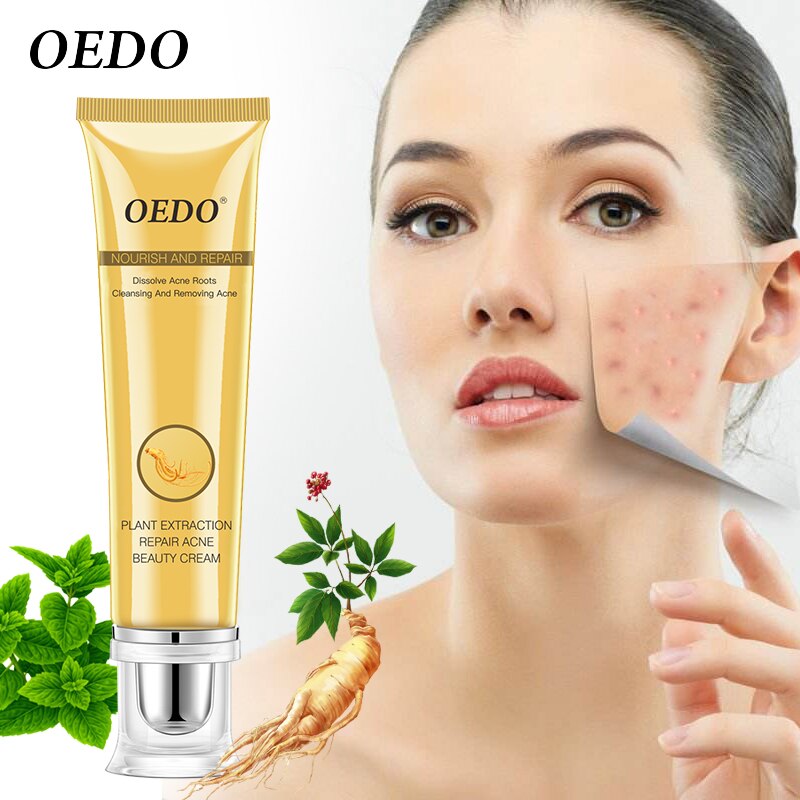 Plant Extraction Repair Acne Cream Ginseng Scutellariae Extract Face Care Acne Treatment Skin Care Facial Cream Whitening 20g