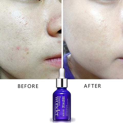 BIOAQUA Blueberry Face Lifting Serum Anti Aging Wonder Essence Skin Care Anti Wrinkle Serum Of Youth Organic Cosmetic Charm