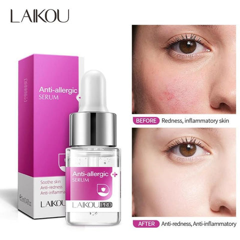 Anti-allergic Serum Chinese Herbal Anti-sensitive Anti-redness Facial Essence Shrink Pore Soothe Skin Treat Acne Face Serum 12ml