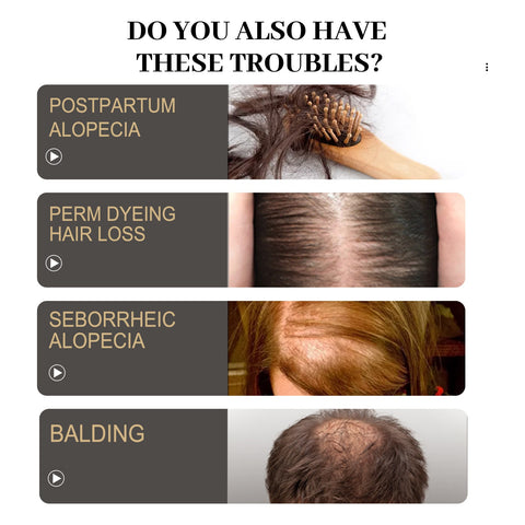 Beyprern Anti Hair Loss Nourishing Solution Damaged Scalp Treatment Spray Fluid Root Strength Follicle Repair Fast Hair Growth Liquid Oil