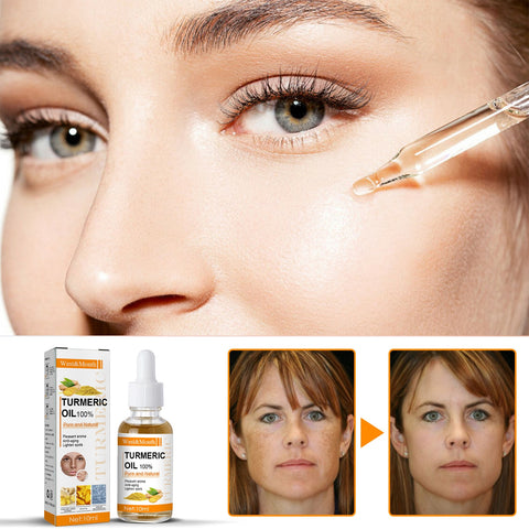 Beyprern Face Care Turmeric Essential Oil Dark Dots Freckles Spots Remove Cosmetics Anti Wrinkles & Aging Whitening Liquid Turmeric Oil
