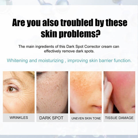 Niacinamide Whitening Freckle Cream Dark Spots Remove Skin Care Product Pigment Correction Moisturizing Brighten Beauty Cosmetic