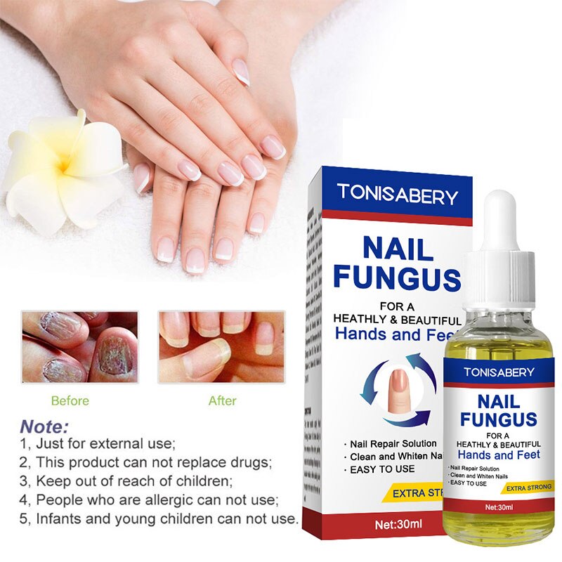 Nail Essence Fungal Treatment Feet Care Against Fungal Nail Oils Nail Fungus Removal Gel Anti Infection Paronychia Onychomycosis