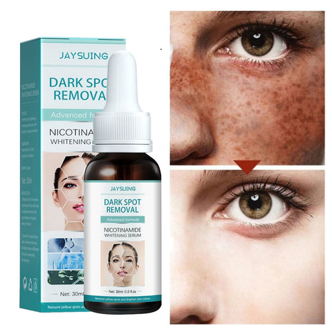 Beyprern Nicotinamide Whitening Freckle Face Serum Remove Dark Spots Melasma Melanin Anti-Wrinkle Brighten Moisturizing Beauty Skin Care