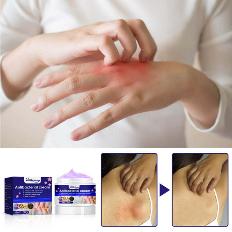 Beyprern Herbal Antibacterial Psoriasis Cream Treatment Dermatitis Eczema Anti-Itch Relief Rash Urticaria Desquamation Body Skin Care 30G