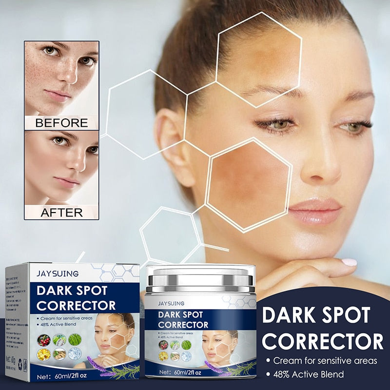 Beyprern Nicotinamide Whitening Freckles Cream Remove Dark Spots Sunburn Spots Age Spots Repair Anti-Aging Moisturizer Brighten Skin Care