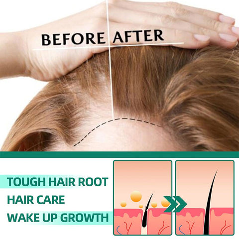 Hair Growth Liquid Moisturize and Protect Hair Treatment Scalp Hair Follicle Anti Hair Loss Natural Beauty Health Hair Care 60ML