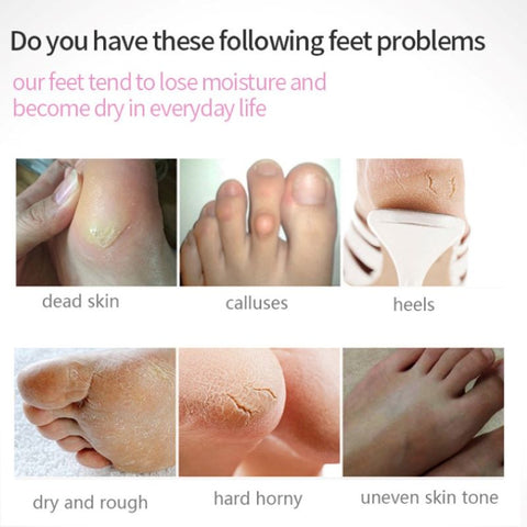 Beyprern 2Pack Peeling Foot Mask Remove Callus Moisturizing Feet Care Socks Rose & Lavender Collagen Exfoliating Whitening Foot Spa Masks