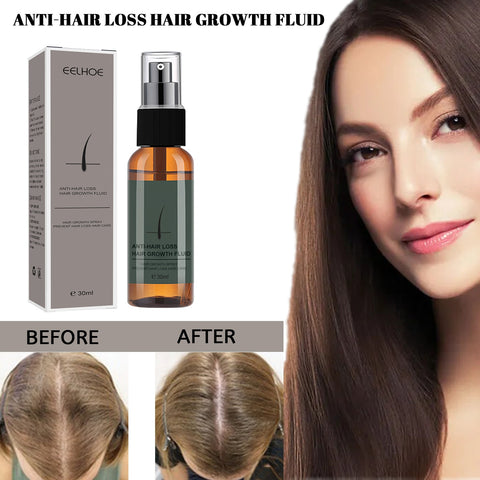 Beyprern Anti Hair Loss Nourishing Solution Damaged Scalp Treatment Spray Fluid Root Strength Follicle Repair Fast Hair Growth Liquid Oil