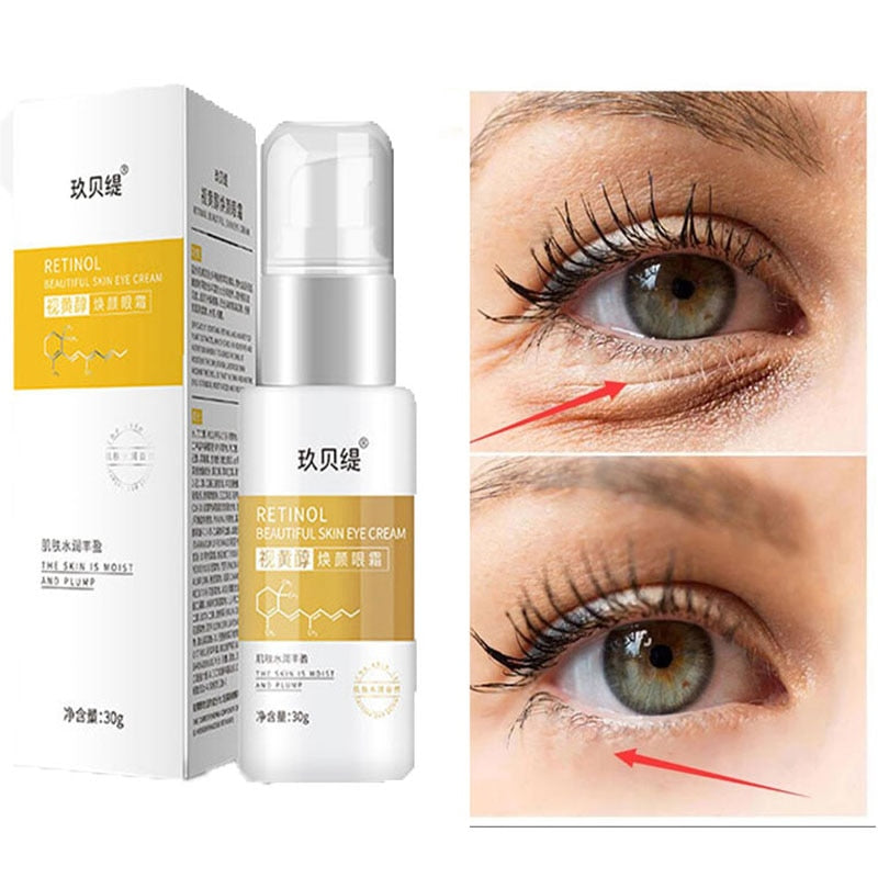Beyprern Retinol Anti-Wrinkle Eye Cream Remove Eye Bag Anti-Dark Circles  Fade Fine Lines Lift Firm Moisturizing Brighten Beauty Products